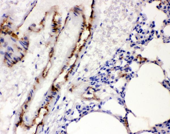Von Willebrand Factor/VWF Rabbit Polyclonal Antibody