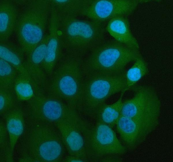 MIF Rabbit Polyclonal Antibody