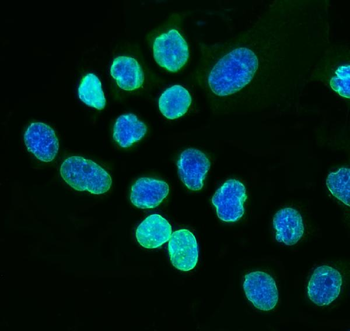 Lamin A+C/LMNA Rabbit Polyclonal Antibody