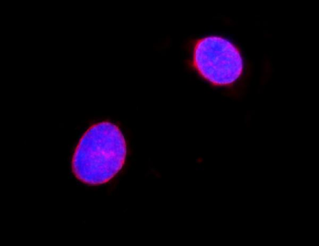 Lamin A+C/LMNA Rabbit Polyclonal Antibody