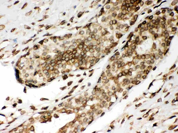 Lamin A+C/LMNA Rabbit Polyclonal Antibody