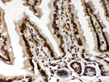 Lamin A+C/LMNA Rabbit Polyclonal Antibody