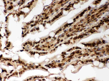 Lamin A+C/LMNA Rabbit Polyclonal Antibody