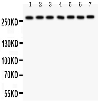 LRRK2 Rabbit Polyclonal Antibody