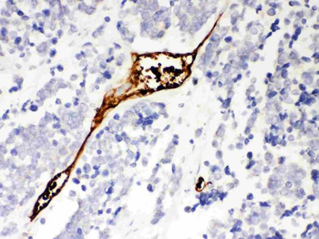 Mesothelin/MSLN Rabbit Polyclonal Antibody