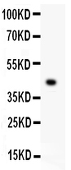 Mesothelin/MSLN Rabbit Polyclonal Antibody