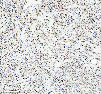 HEF1/NEDD9 Rabbit Polyclonal Antibody