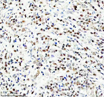 HEF1/NEDD9 Rabbit Polyclonal Antibody
