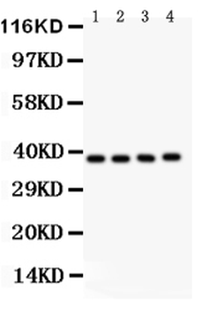 IKB beta/NFKBIB Rabbit Polyclonal Antibody
