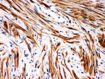 IKB beta/NFKBIB Rabbit Polyclonal Antibody