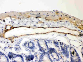 IKB beta/NFKBIB Rabbit Polyclonal Antibody
