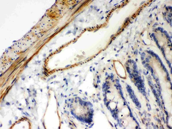 IKB beta/NFKBIB Rabbit Polyclonal Antibody