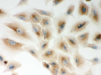 CARD4/NOD1 Rabbit Polyclonal Antibody