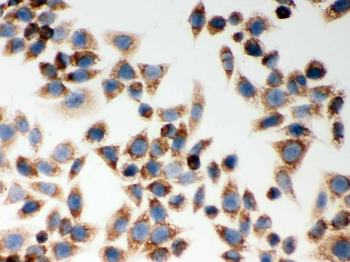 CARD4/NOD1 Rabbit Polyclonal Antibody
