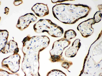 CARD4/NOD1 Rabbit Polyclonal Antibody