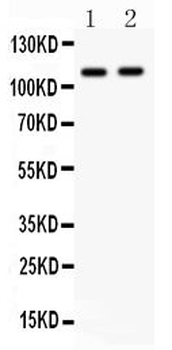 CARD4/NOD1 Rabbit Polyclonal Antibody