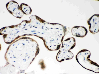 PAPP A/PAPPA Rabbit Polyclonal Antibody
