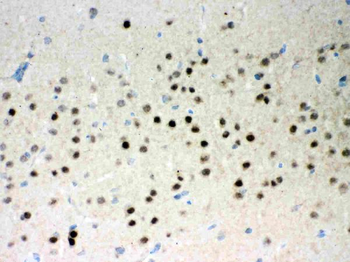 Parkin/PRKN Rabbit Polyclonal Antibody