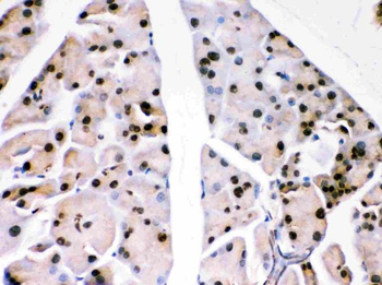 PARK7/DJ1 Rabbit Polyclonal Antibody