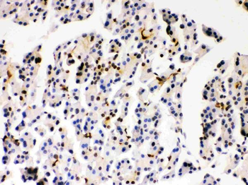 PARK7/DJ1 Rabbit Polyclonal Antibody