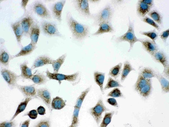 PARK7/DJ1 Rabbit Polyclonal Antibody