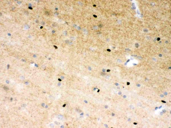 PARP/PARP1 Rabbit Polyclonal Antibody