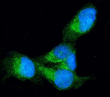 Profilin 1/PFN1 Rabbit Polyclonal Antibody