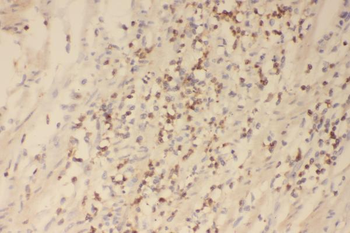 Profilin 1/PFN1 Rabbit Polyclonal Antibody