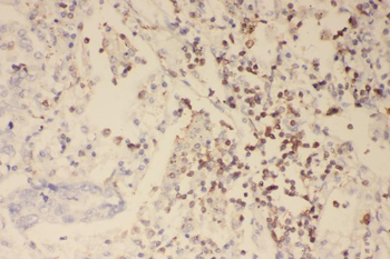 Profilin 1/PFN1 Rabbit Polyclonal Antibody