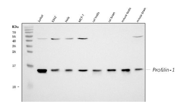 Profilin 1/PFN1 Rabbit Polyclonal Antibody