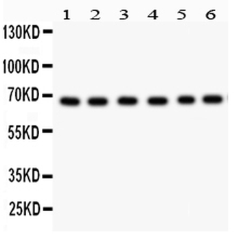 PKC iota/PRKCI Rabbit Polyclonal Antibody