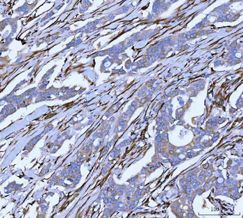 Hsp47/SERPINH1 Rabbit Polyclonal Antibody