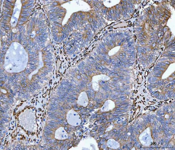 Hsp47/SERPINH1 Rabbit Polyclonal Antibody
