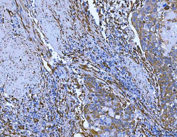 Hsp47/SERPINH1 Rabbit Polyclonal Antibody