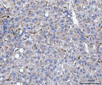 Hsp47/SERPINH1 Rabbit Polyclonal Antibody