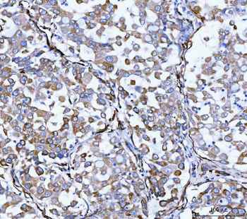 Hsp47/SERPINH1 Rabbit Polyclonal Antibody