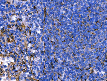 Hsp47/SERPINH1 Rabbit Polyclonal Antibody