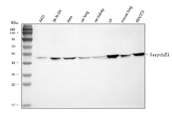 Hsp47/SERPINH1 Rabbit Polyclonal Antibody