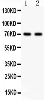 Sex Hormone Binding Globulin/SHBG Rabbit Polyclonal Antibody