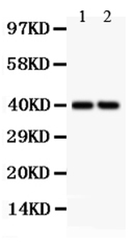SFRP4 Rabbit Polyclonal Antibody