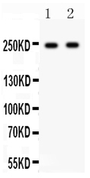 CaV1.3/CACNA1D Rabbit Polyclonal Antibody