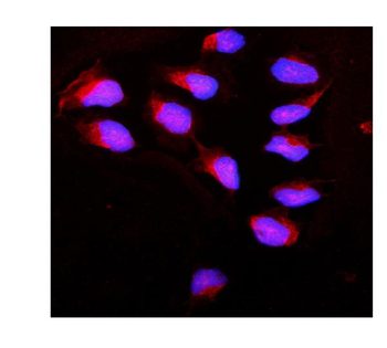 Calpain 1/CAPN1 Rabbit Polyclonal Antibody