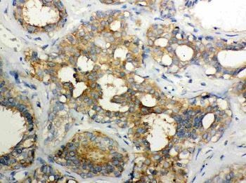 Calpain 1/CAPN1 Rabbit Polyclonal Antibody