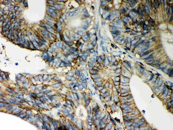 CD44 Rabbit Polyclonal Antibody