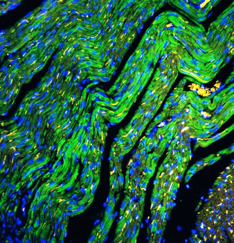 Cytochrome C/CYCS Rabbit Polyclonal Antibody