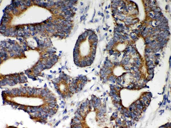 Hsp60/HSPD1 Rabbit Polyclonal Antibody