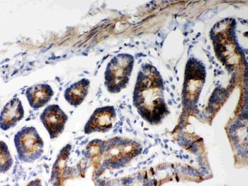Hsp60/HSPD1 Rabbit Polyclonal Antibody