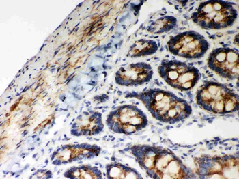 Hsp60/HSPD1 Rabbit Polyclonal Antibody