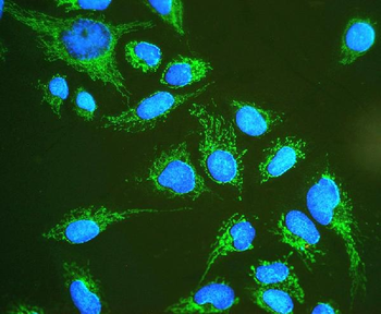 Hsp60/HSPD1 Rabbit Polyclonal Antibody