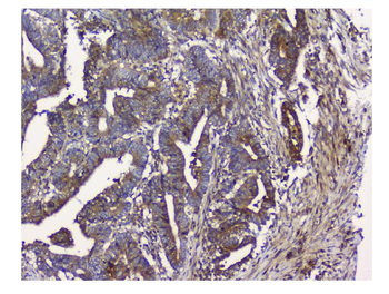 N myc interactor/NMI Rabbit Polyclonal Antibody